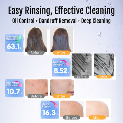 Profesional Micro Nano Bubble Spa Machine   Hydrogen Nanobubble Generator untuk peremajaan kulit, hidrasi & anti-penuaan perawatan kecantikan